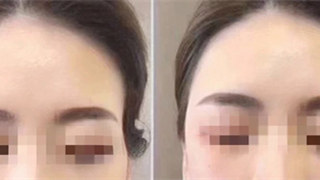 |案例招募|人见人厌的“脂肪”竟是回归少女的利器？